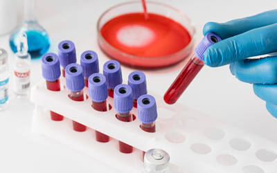 Анализы – Квинмед Анализы – Квинмед